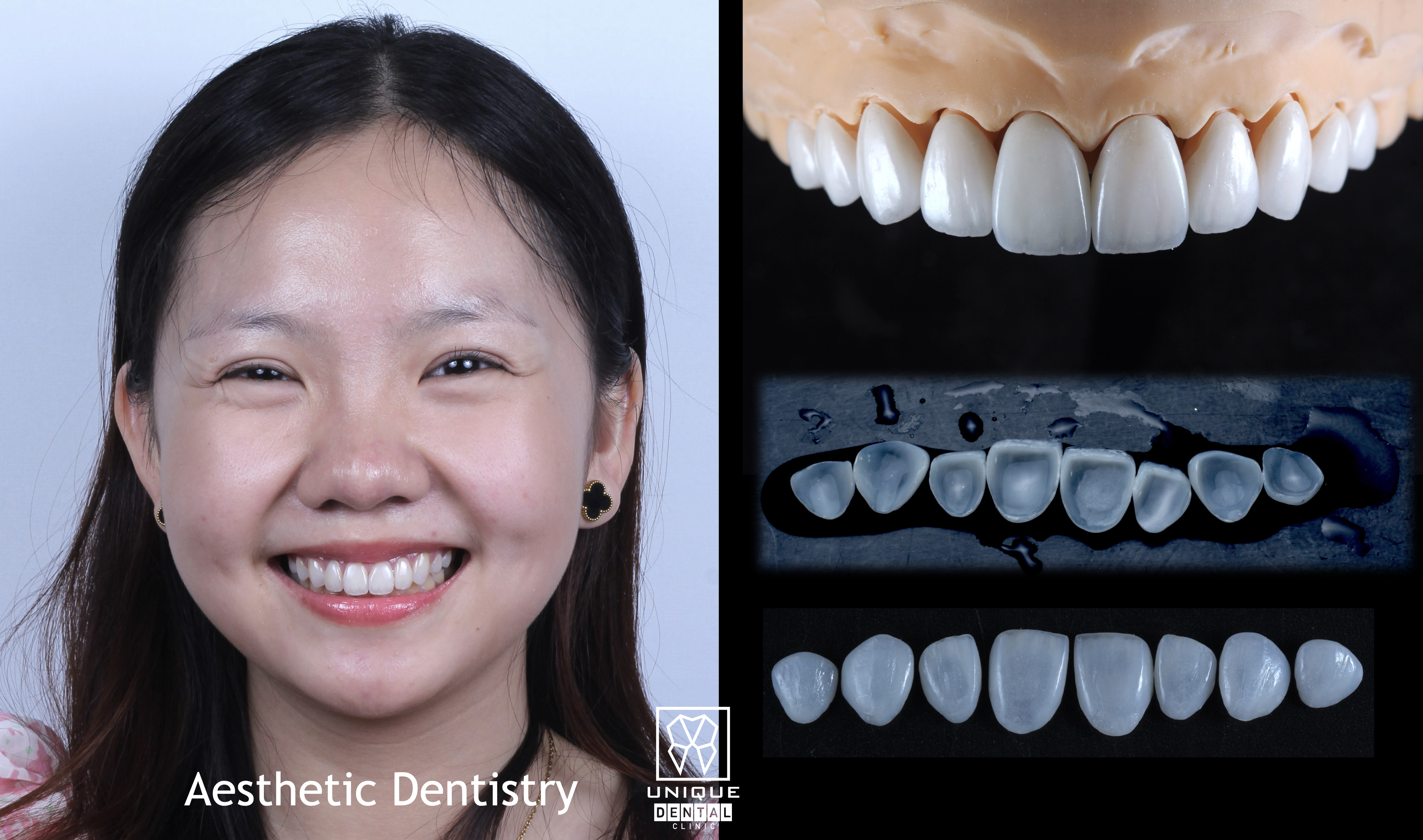 Aesthetics Treatment